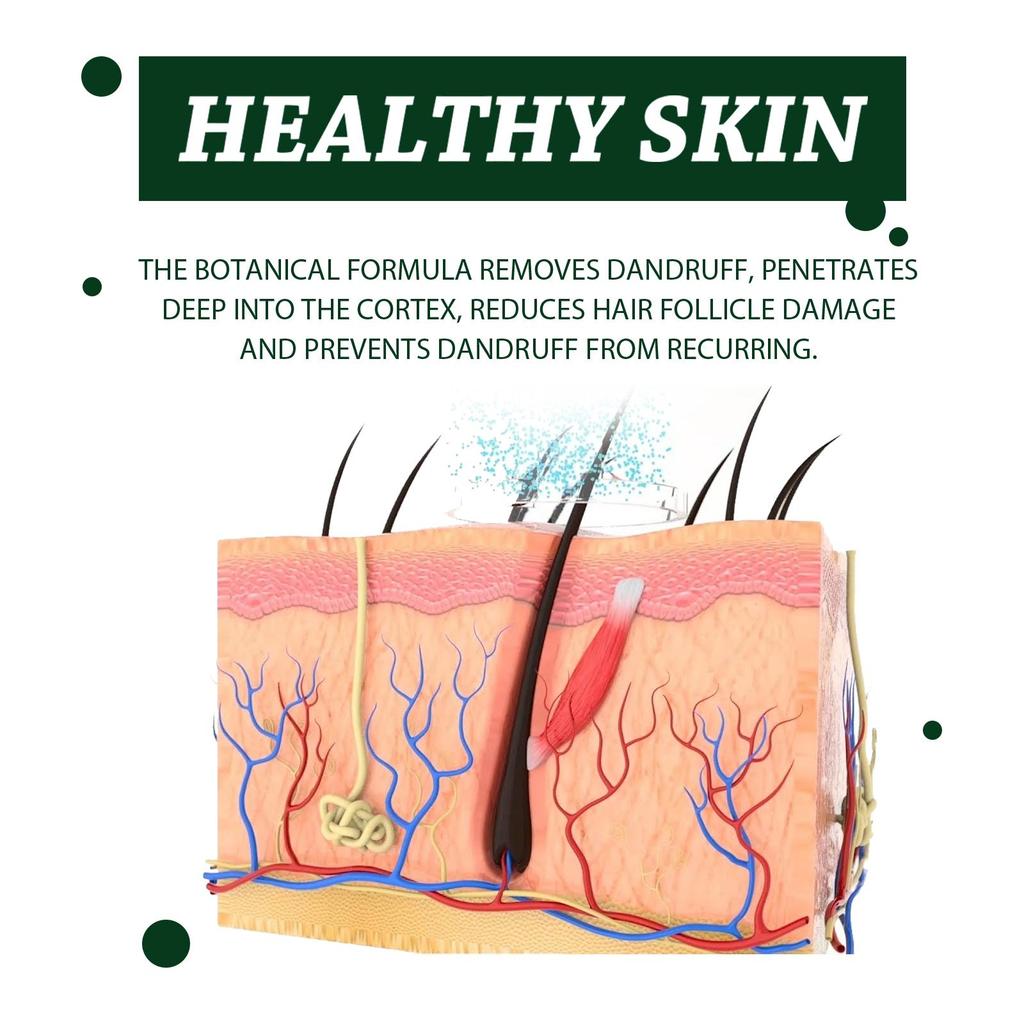 South Moon Scalp Care Shampoo 100ml Gently Cleanses, Controls Oil, and Adds Volume, Leaving Hair Smooth and Full-bodied.