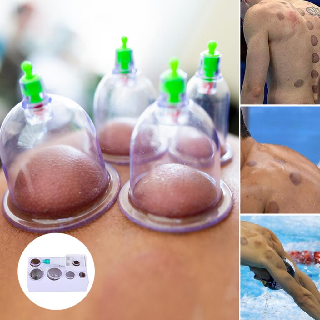 Zestaw do masażu bańkami, Domowy aparat do baniek, Bańki na ból