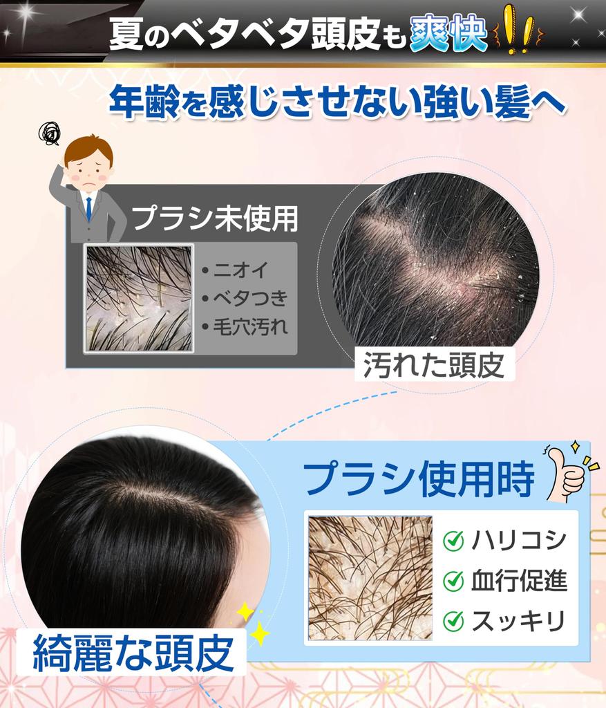 JOYSTECH Soft Scalp Massage Brush (Purple) - Shampoo Brush for Women, Recommended by Hair Analysts.