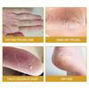 Eelhoe Skin Crack Banana Repair Cream Nourishing Foot Cream For Dry Cracked Skin