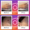 Foundation Tape Piercing Mole Same 5 Sheets For Face and Ears (Clear Concealer, Concealer), Round, Color, (30 Sheets), (Pink Ochre)