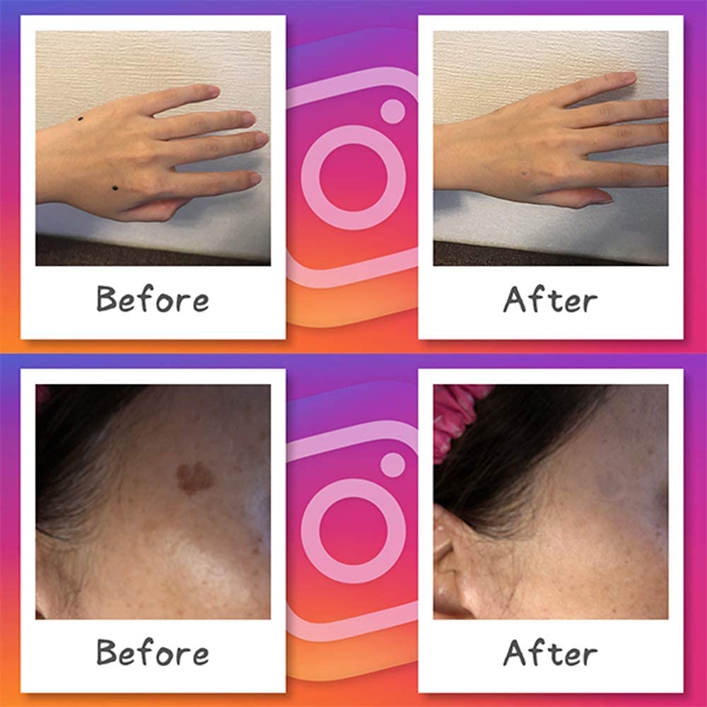 Foundation Tape Piercing Mole Same 5 Sheets For Face and Ears (Clear Concealer, Concealer), Round, Color, (30 Sheets), (Pink Ochre)