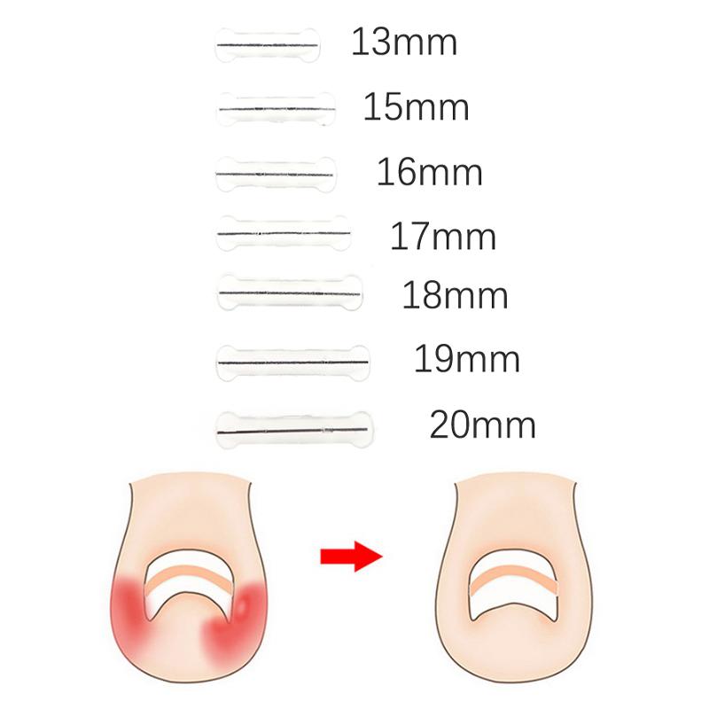 Ingrown Toenail Corrector Tools Pedicure Recover Embed Toe Nail Treatment Elastic Patch Sticker Straightening Clip Brace 13-20MM