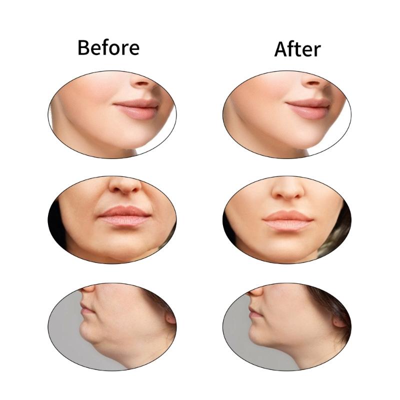 Electric V Face Machine Facelift Belt Machine Face Lifting Machine Skin Tightening Machine Double Chin Remover for Woman