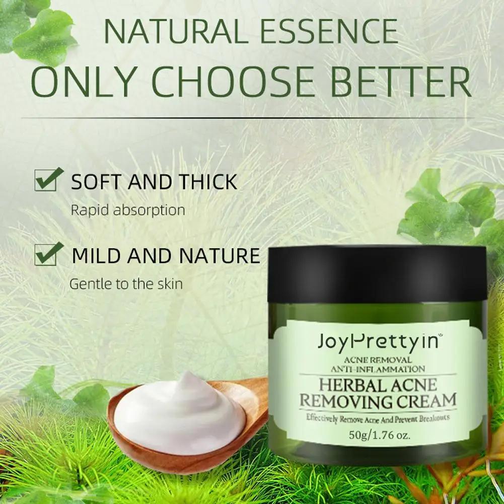 Crème anti-acné pour le visage, élimine les pores dilatés, traite l'acné, contrôle du sébum, réduit les pores, crème pour le visage, soins de la peau, beauté et santé