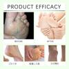 Urea Cream 60% for Feet [Developed In Collaboration with Foot Care Hygiene Specialists] Moisturizing Hands. Softens Dead Skin Cells and Promotes Optim