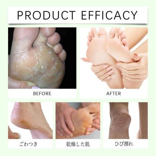 Urea Cream 60% for Feet [Developed In Collaboration with Foot Care Hygiene Specialists] Moisturizing Hands. Softens Dead Skin Cells and Promotes Optim