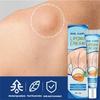 20g Lipoma Soothing Gel Instant Ointment Relieving Discomfort Agglomerat