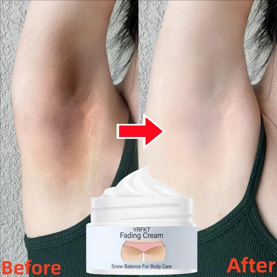 Whitening and Moisturizing Body Cream, Whitening the Bikini Area, Armpits, Knees, Etc., Preventing Skin Dryness and Improving Melanin Deposition