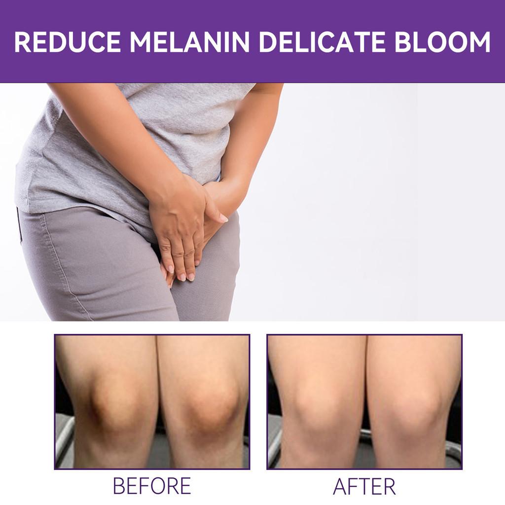 Rejuvenating Tender Red Cream For Softening Dark Elbows And Brightener Skin