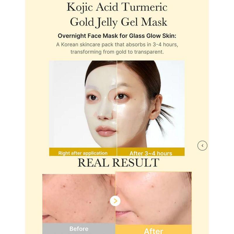 medicube - Kojic Acid Turmeric Brightening Gel Mask Set
