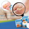 1/2pcs Jiagoukang Cream Thick Toenail Care Cream