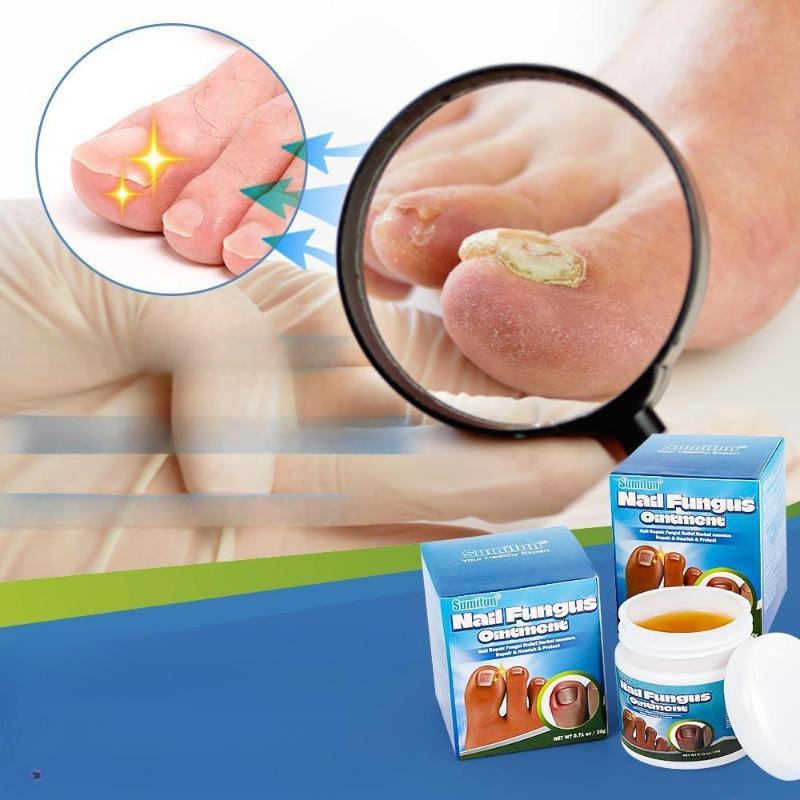 1/2pcs Jiagoukang Cream Thick Toenail Care Cream