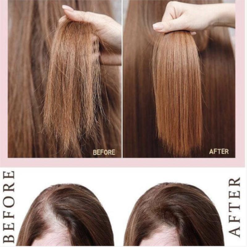 MD:1 Hair Therapy Complesso Peptidico Intensivo Cura Secrezione Sebacea Ampolla 10ml 20 Pezzi