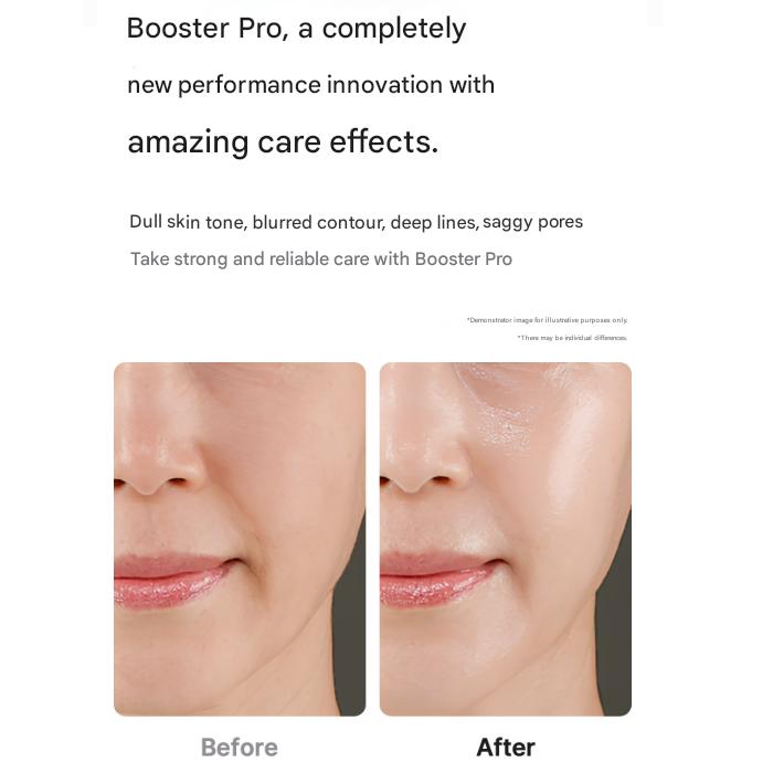 Medicube [AGE‑R] Booster Pro