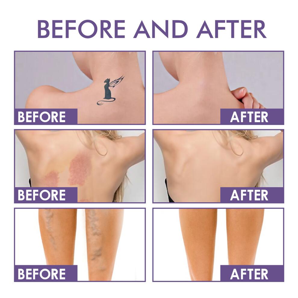 Body Concealer 74ml Waterproof Cover Up for Tattoos Scars Birthmarks Skin Brightening