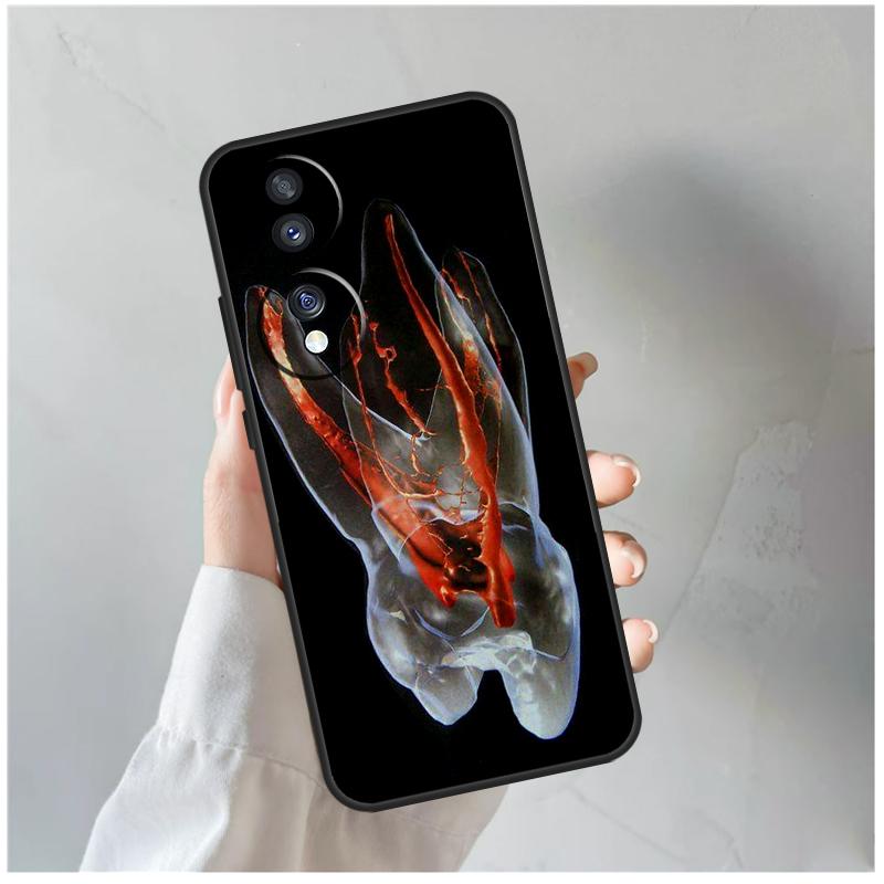 Human Tooth Anatomy For Honor Magic 8 7 6 5 Pro Case For Honor 400 200 Lite 90 70 50 X8c X8b X9a X9b X9c X9d Win