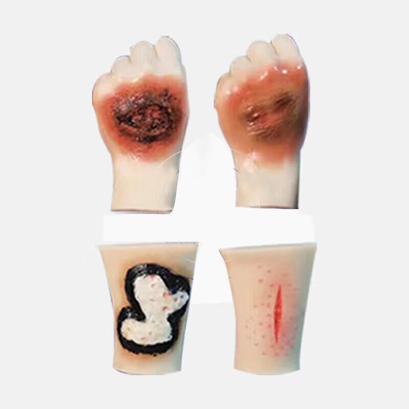 Human Poisoning Simulation Training Model