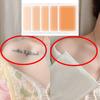 8Pcs Temporary Birthmark Concealing Sticker Skin Color Scar Concealer Sticker  Black Spot