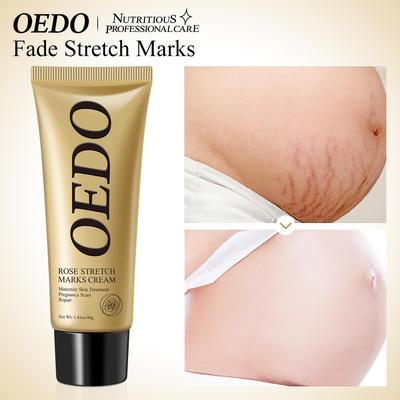 Rose Pregnancy Cream - Repairs Stretch Marks & Improves Elasticity