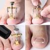 1/3/5PC Ingrown Toenail Corrector Straightening Clip Pedicure Foot Nail Care Tools Stainless Steel Pedicure Treatment Correction