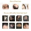 Anti-Alopezie-Haarwachstumsserum, ätherisches Öl, Anti-Haarausfall-Spray-Produkte, Ingwer-Behandlung, trockenes, krauses, beschädigtes Haar