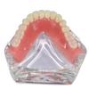 Modello Denti Dentali Trasparente 4 Impianti Overdenture Ponte Rimovibile Modello Mandibolare Inferiore M6003 Materiali per Studio Dentistico