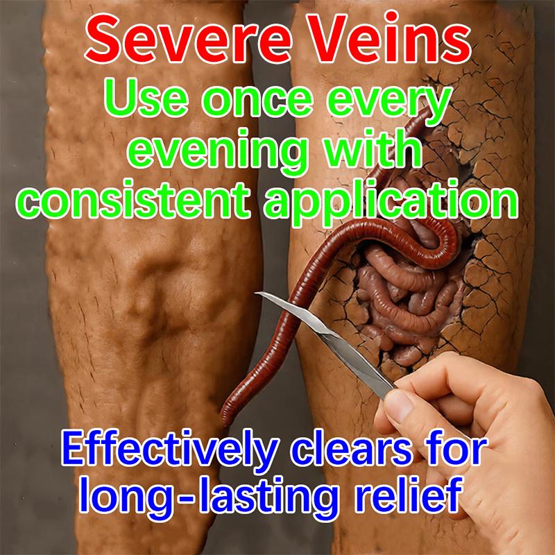 Varicose Veins Cream with Herbal Extract