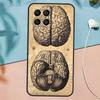 Human Heart Anatomy Case For Samsung Galaxy M54 M14 M34 M13 M53 M56 M52 M32 M16 M11 M21 M31 M35 M12 M15 M36 M55