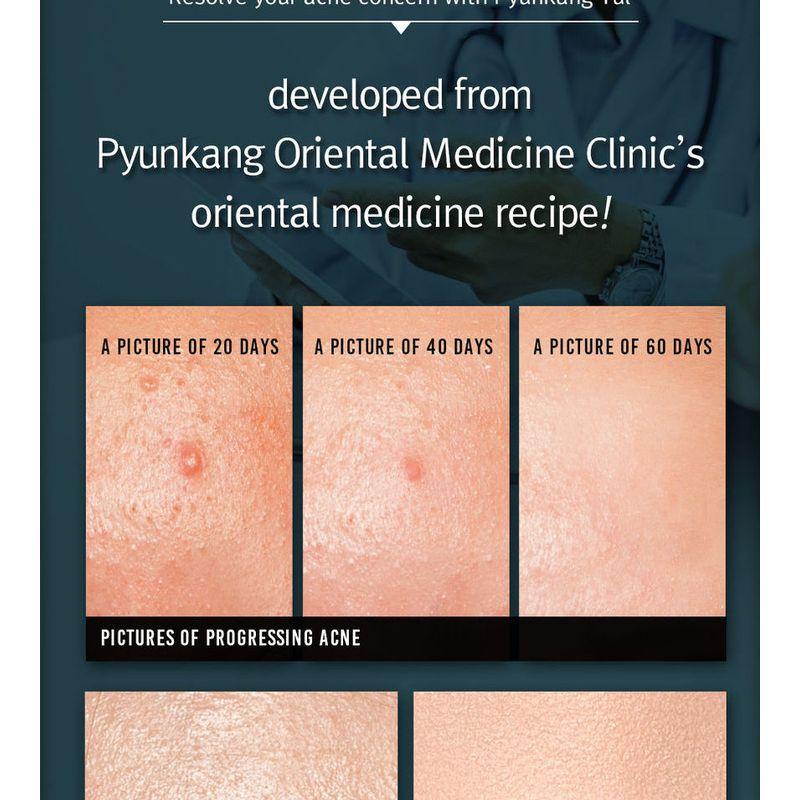 Pyunkang Yul Acne Cream 50ml