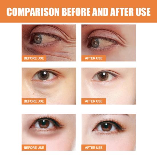 Vitamin-C Eye Stick for Dark Circles 4ml Anti-Wrinkle Eye Cream for Fine Lines & Puffiness Firming Hydrating under Eye Treatment
