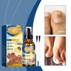 Nail Fungus Treatment Serum Spray Repair Dryness Cracking Infection Fungal Nail Remove Inflammation Swelling Foot Care Products