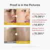 Medikube Koji Säure Vita Peeling Shot Große Kapazität Peeling Exfoliation Pflege Gommage Sommer Maßnahmen Mattheit Enthält KOJICAICD
