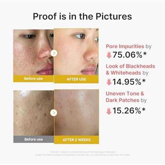 Medikube Koji Säure Vita Peeling Shot Große Kapazität Peeling Exfoliation Pflege Gommage Sommer Maßnahmen Mattheit Enthält KOJICAICD