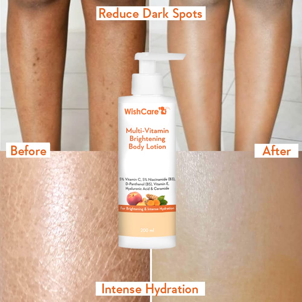 WishCare Multi-Vitamin Brightening Body Lotion 200 Ml for Men & Women Hydrating Skin Care