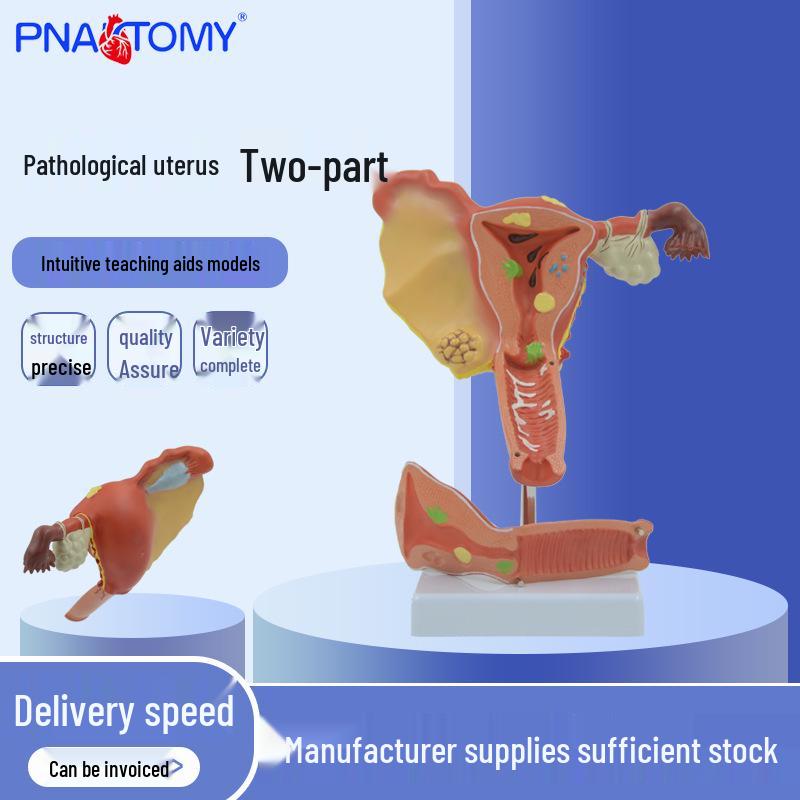 Pathological Uterus and Fallopian Tube Simulation Model for Teaching and Training 20x15x15 cm