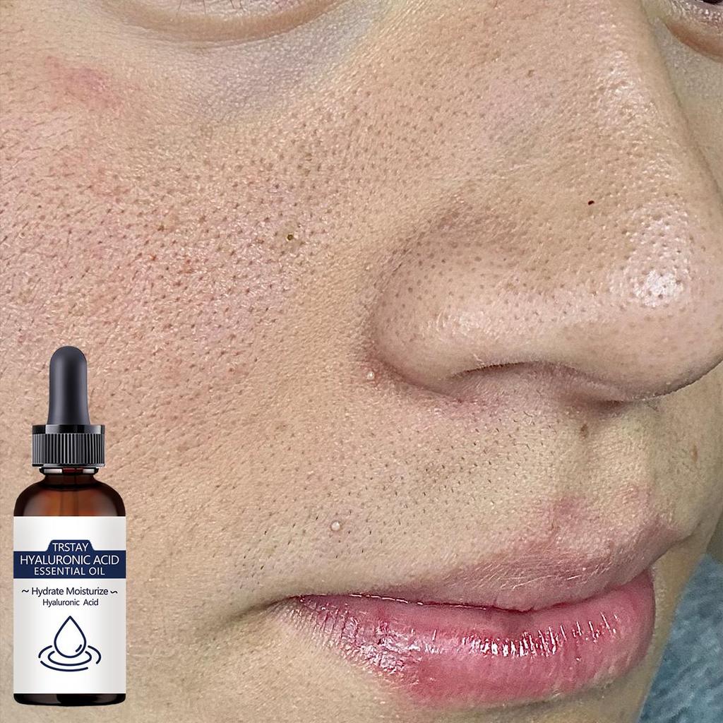 Hypoallergenic Face Cream With Collagen & Hyaluronic Acid – Moisturizing, Firming, Wrinkle-Smoothing & Pore Shrinking - Suitable For All Skin Types