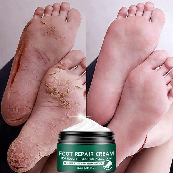 La più recente crema idratante riparatrice per la pelle delle mani e dei piedi anti-screpolature per piedi screpolati, secchi e screpolati, crema per i piedi riparatrice del tallone