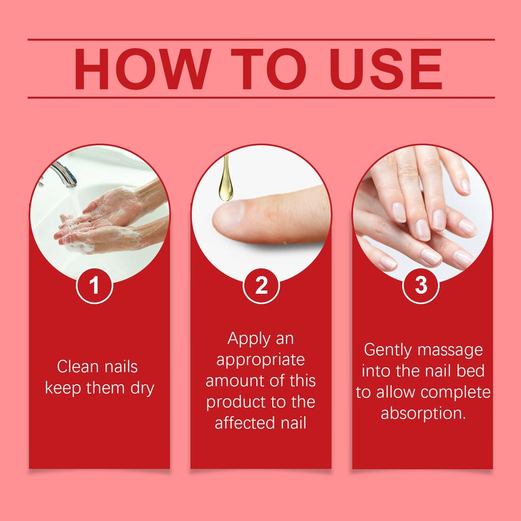 Rosehip Oil Nail Care Liquid Nourishing Moisturizing To Remove Onychomycosis Hand And Foot Nail Care Products Fungus Care 30ML