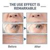 3Pcs Hyalu B5 Concentrate Anti-Wrinkle Repairing Serum 30ml - Skincare for Aging Skin