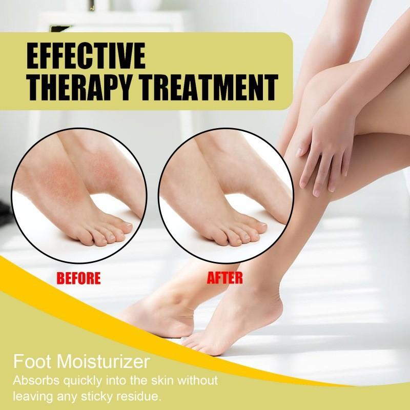 Eelhoe Moisturizing Foot Care Spray For Exfoliating Dead Skin And Softening Calluses 30ml