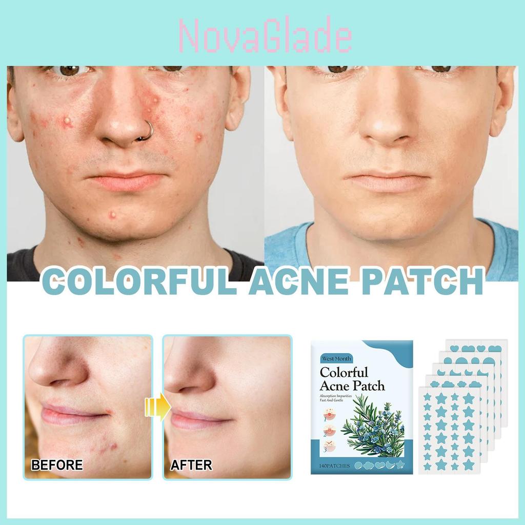 West Month Blue Acne Patches Gentle Deep Cleansing Repairing Spot Treatment For Clear Skin