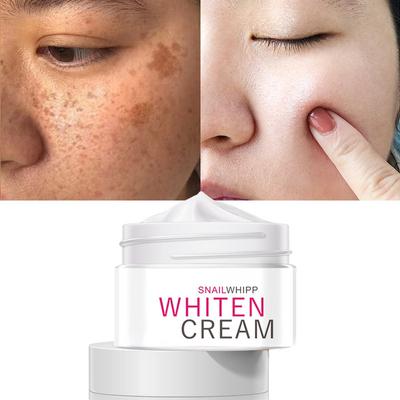 Hautaufhellende Aufhellungscreme, Spotted Freckle Fade Cream