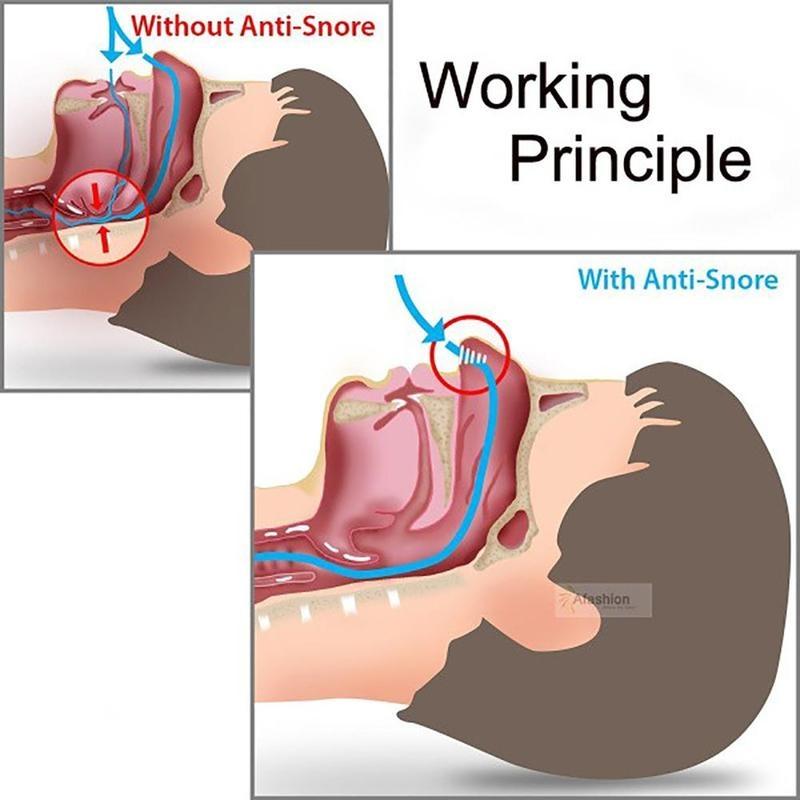 Stopp Anti-Schnarchlösung Gerät Schnarchstopper Mundstück Schiene Stopper Schlaf