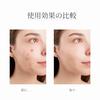 Acne Patch Hydrocolloid That Covers Face Invisible Spot Suitable All Skin Types (150 Pieces)