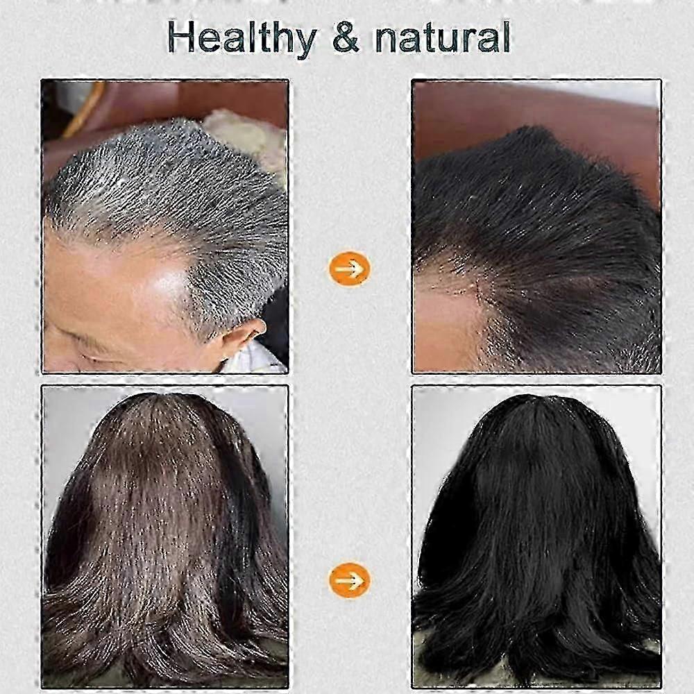 2025 Natural Plant Hair Dye, New Botanical Bubble Hair Dye 10Packs/Box