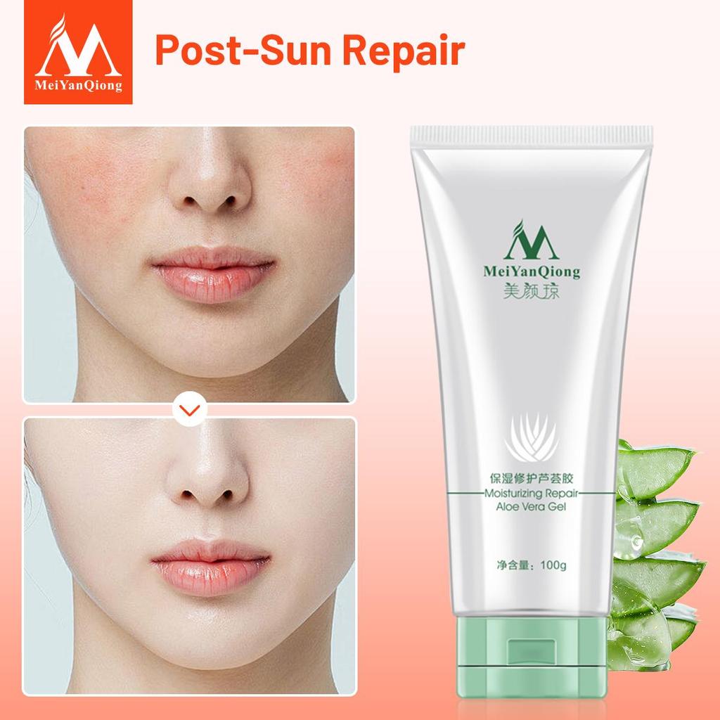 Kaufe MeiYanQiong Aloe Vera Gel - Hautpflege & Feuchtigkeit 100g zum Preis  ab 5.18 | Joom