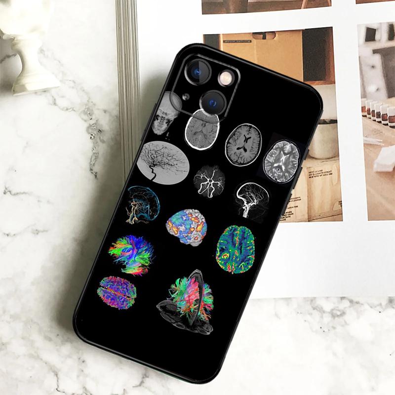 Anatomy Brain Phone Case For iPhone 17 16 15 14 12 11 13 Pro Max Plus 12 13 Mini 16e 17 Air Cover Coque