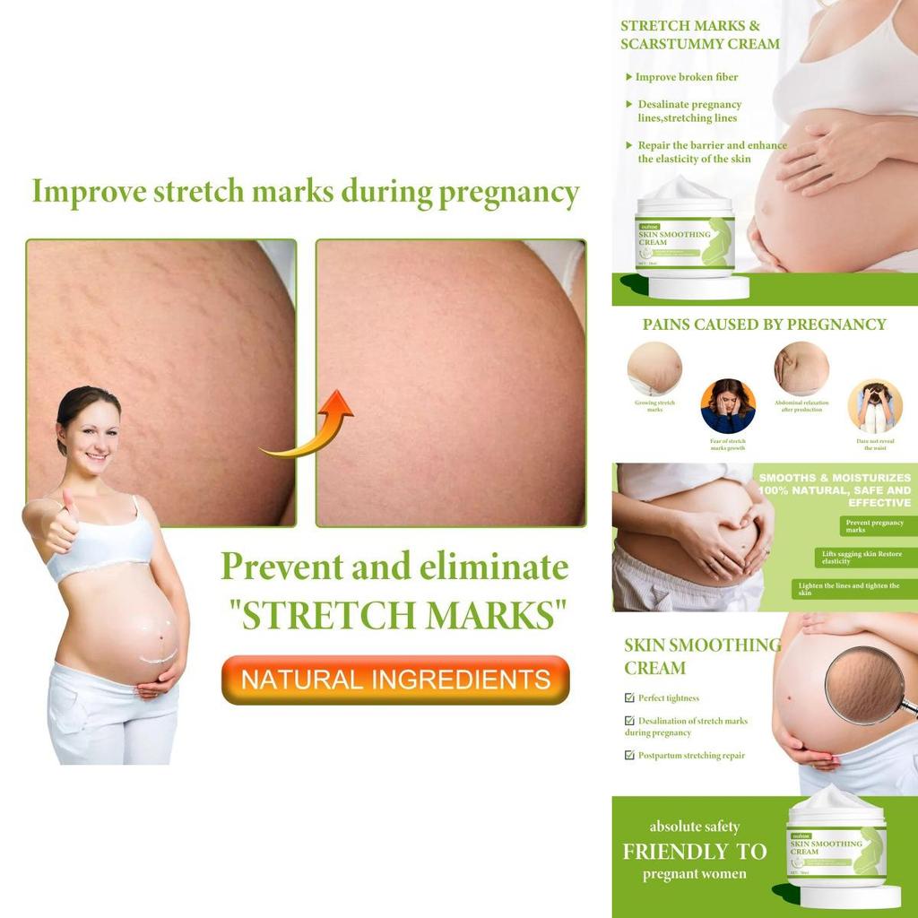 Ouhoe Skin Smoothing Cream Moisturizing Formula For Scar Reduction And Stretch Marks