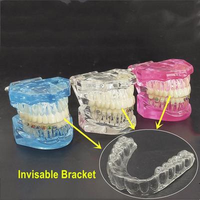 Dental Tooth Model Orthodontic Model for Patient Communication Dental Study Teeth Model with Invisible Transparent Bracket Dentist Models